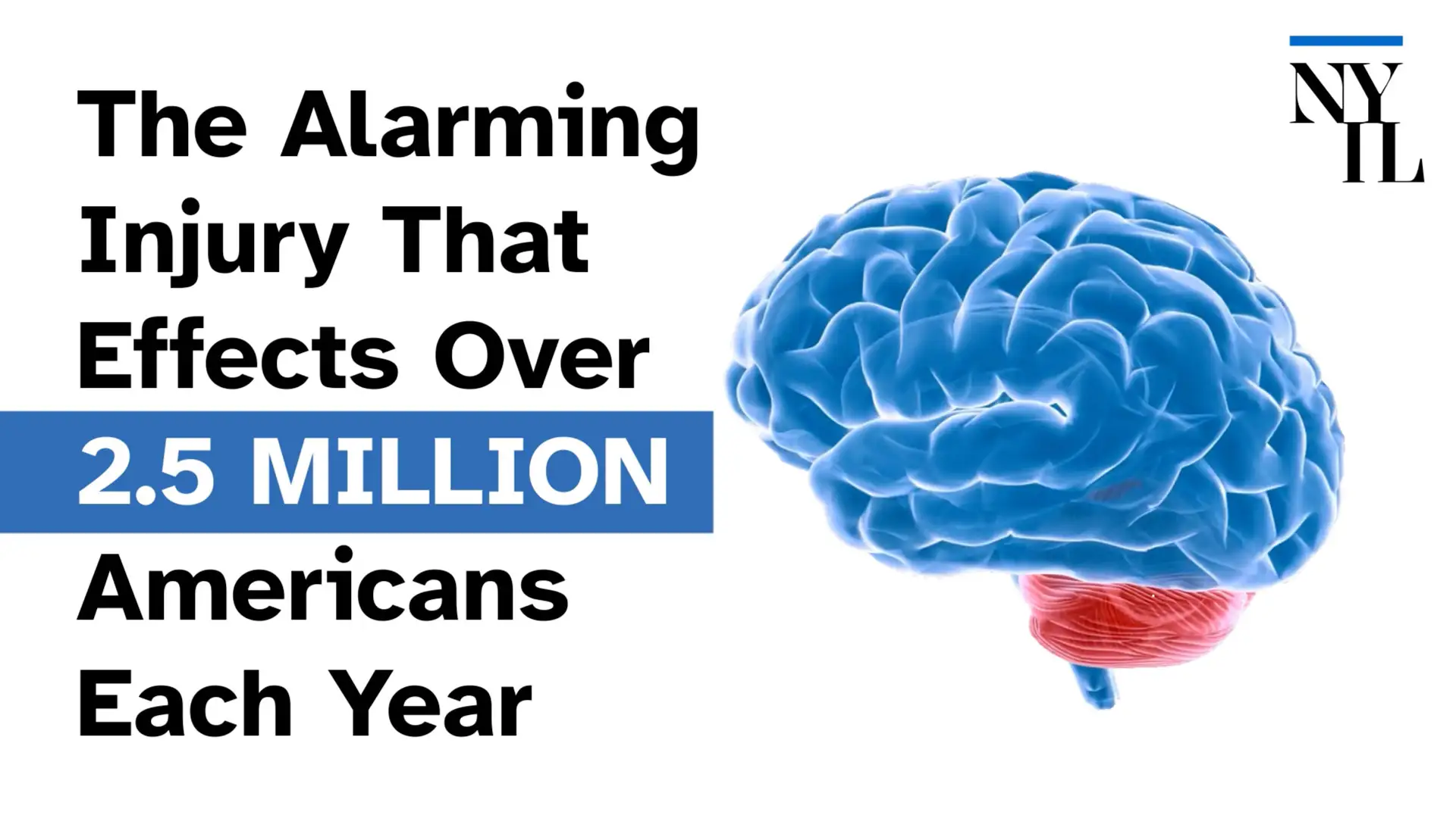 The Alarming Injury That Effects Over 2.5 Million People Each Year
